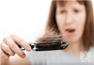 中年妇女脱发是什么原因