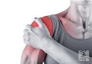 肩周炎的症状特点  肩周炎有哪些表现？