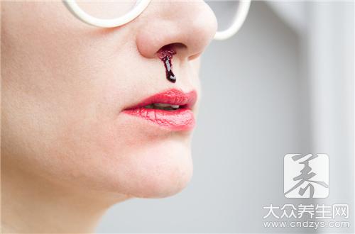 鼻子经常出血怎么办 推荐治疗鼻出血的食疗方