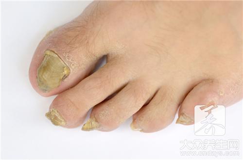 脚趾头麻木是什么原因，三种因素诱发这种现象